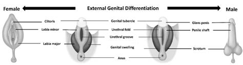 External Genitalia of an Intersex Individual